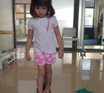 Galeria - Rehabilitacja skoliozy - porady mgr Justyny Iwanek - fizjoterapeuty dziecięcego 